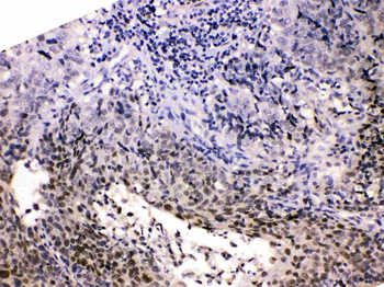HDGF Rabbit Polyclonal Antibody
