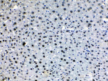 HDGF Rabbit Polyclonal Antibody