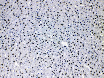 HDGF Rabbit Polyclonal Antibody