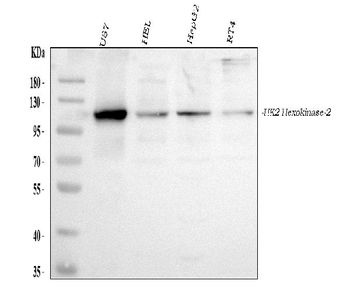 Hexokinase II/HK2 Rabbit Polyclonal Antibody
