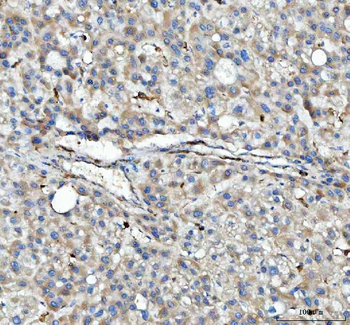 HLA-DPB1/HLA Rabbit Polyclonal Antibody