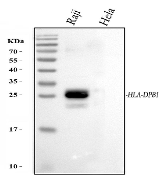 HLA-DPB1/HLA Rabbit Polyclonal Antibody