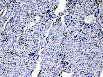 HnRNP A1/HNRNPA1 Antibody