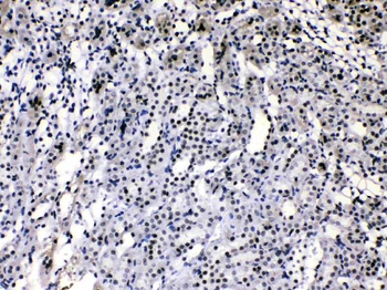 HnRNP A1/HNRNPA1 Antibody