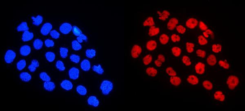 HnRNP A1/HNRNPA1 Antibody
