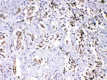 HnRNP F/HNRNPF Rabbit Polyclonal Antibody