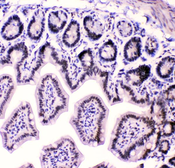 HnRNP F/HNRNPF Rabbit Polyclonal Antibody