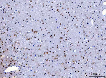 HnRNP H/HNRNPH1 Antibody