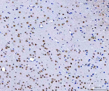 HnRNP H/HNRNPH1 Antibody