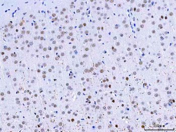 HnRNP H/HNRNPH1 Antibody