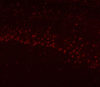 HnRNP H/HNRNPH1 Antibody