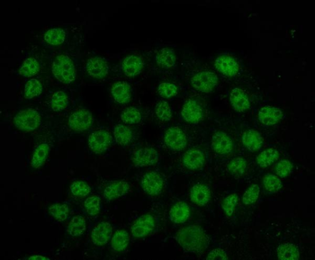 HnRNP H/HNRNPH1 Antibody