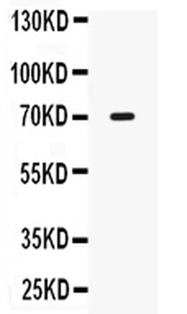 IL12RB1 Rabbit Polyclonal Antibody