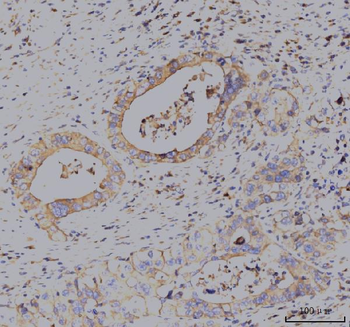 KCNQ1 Antibody