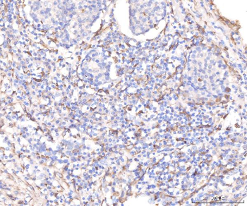 KCNQ1 Antibody