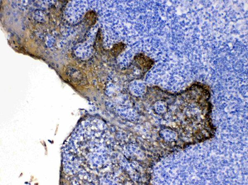 Cytokeratin 5/KRT5 Rabbit Polyclonal Antibody