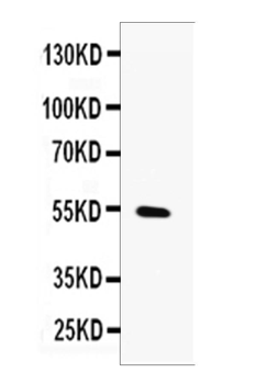 MMP13 Rabbit Polyclonal Antibody