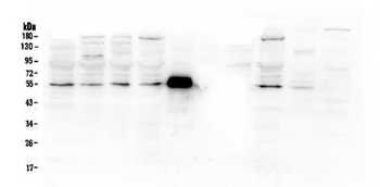 MMP13 Rabbit Polyclonal Antibody