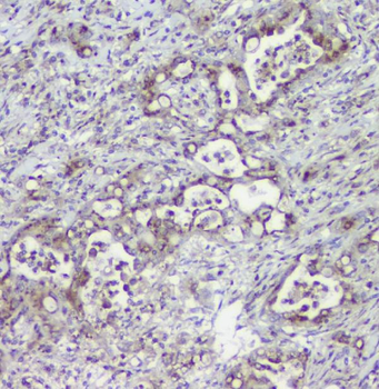 Mannose Phosphate Isomerase/MPI Rabbit Polyclonal Antibody