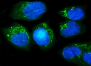 Methylmalonyl Coenzyme A mutase Rabbit Polyclonal Antibody