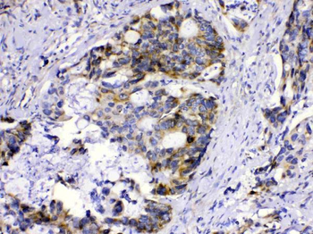 Methylmalonyl Coenzyme A mutase Rabbit Polyclonal Antibody