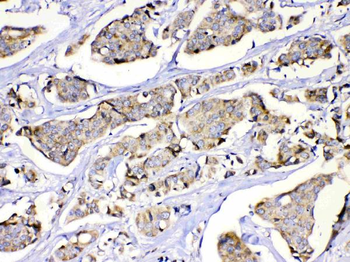 Methylmalonyl Coenzyme A mutase Rabbit Polyclonal Antibody