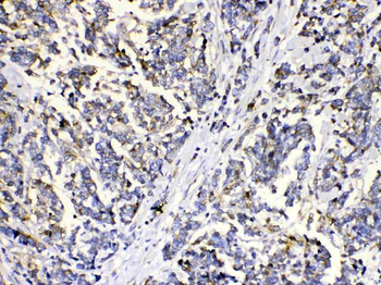 Methylmalonyl Coenzyme A mutase Rabbit Polyclonal Antibody