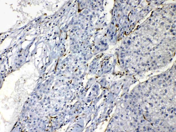 Nucleoside phosphorylase/PNP Antibody