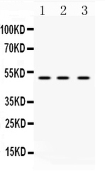DR4/TNFRSF10A Rabbit Polyclonal Antibody