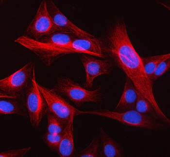 Beta Tubulin/TUBB Rabbit Polyclonal Antibody