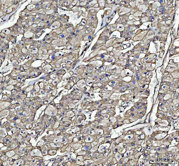 Beta Tubulin/TUBB Rabbit Polyclonal Antibody