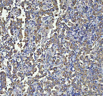Beta Tubulin/TUBB Rabbit Polyclonal Antibody