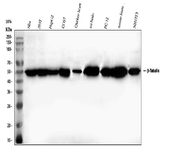 Beta Tubulin/TUBB Rabbit Polyclonal Antibody