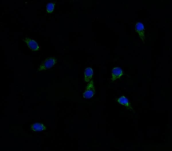 ABCG8 Rabbit Polyclonal Antibody