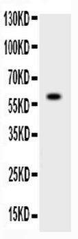ADAMTS4/ADAMTS4 Rabbit Polyclonal Antibody