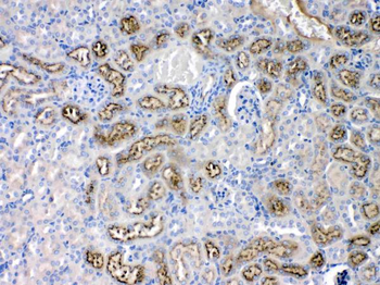 Angiotensinogen/AGT Rabbit Polyclonal Antibody