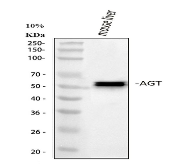 Angiotensinogen/AGT Rabbit Polyclonal Antibody