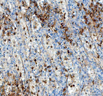 Angiopoietin-like 4/ANGPTL4 Rabbit Polyclonal Antibody