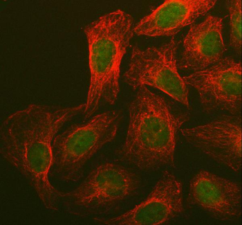 BRCA1 Rabbit Polyclonal Antibody