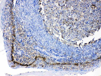 CD147/Emmprin/BSG Antibody