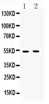 Muscarinic Acetylcholine Receptor 2/CHRM2 Rabbit Polyclonal Antibody