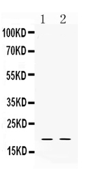 Alpha Defensin 1/DEFA1 Rabbit Polyclonal Antibody