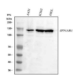 IFNAR1 Rabbit Polyclonal Antibody