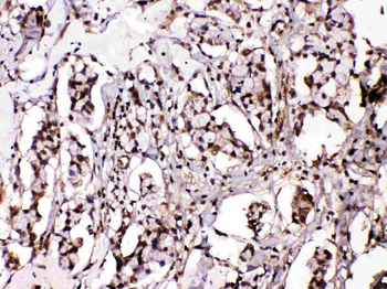 Islet 1/ISL1 Rabbit Polyclonal Antibody