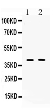 Islet 1/ISL1 Rabbit Polyclonal Antibody
