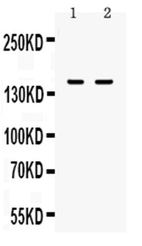 CD11a/ITGAL Rabbit Polyclonal Antibody