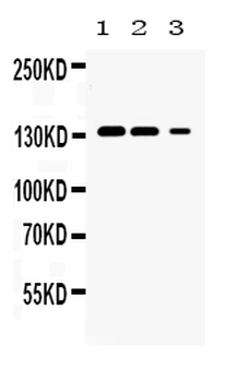 JAK1 Rabbit Polyclonal Antibody
