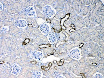 Cytokeratin 18/KRT18 Antibody