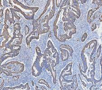 Cytokeratin 18/KRT18 Antibody