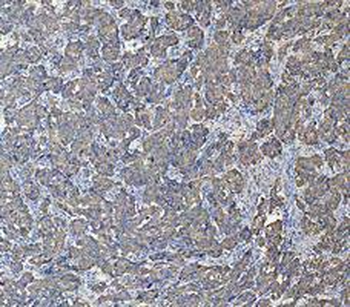 Cytokeratin 18/KRT18 Antibody